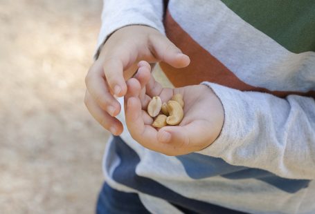 Nut Allergies, Symptoms and Treatments